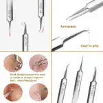 Fecong™ Stainless Steel Blackhead Removal Kit