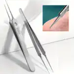 Fecong™ Stainless Steel Blackhead Removal Kit