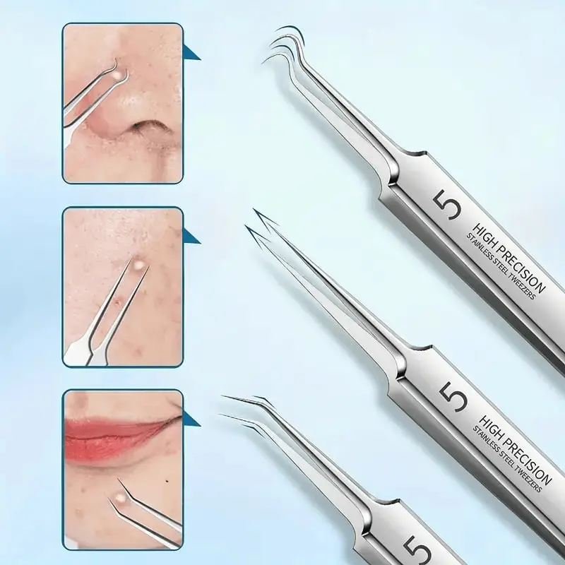 Acne treatment tools